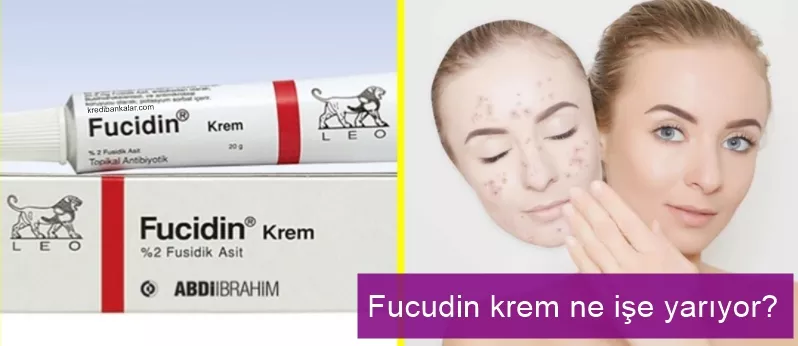 Fucidin krem ne işe yarar, nasıl kullanılır, yan etkileri nelerdir?